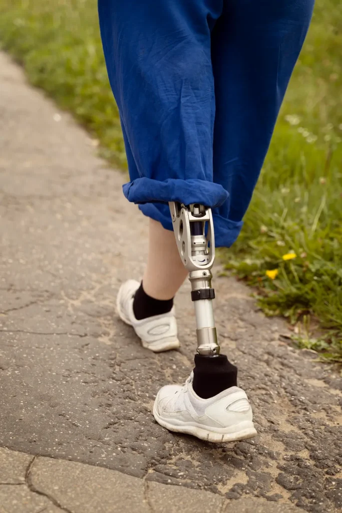 NDIS Physiotherapist Bundaberg